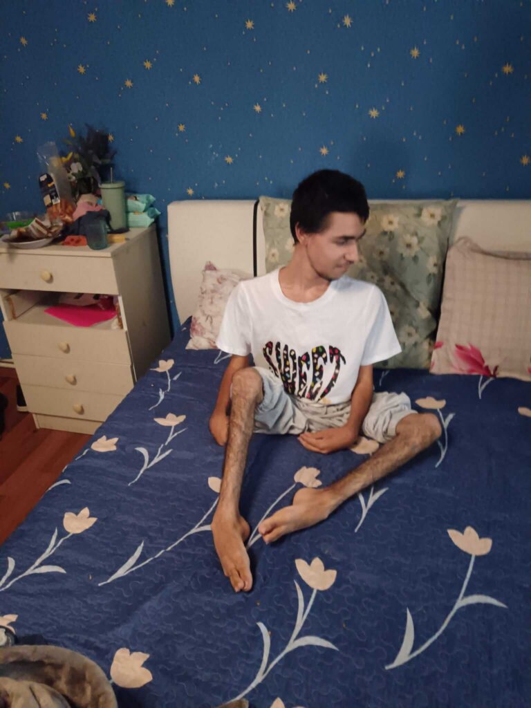 Orbul Bartimeu